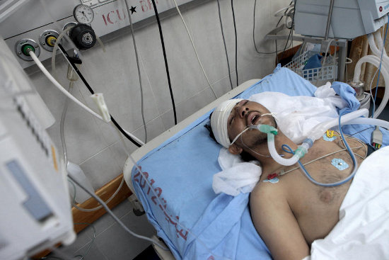 Ahmad Darwish, a 23-year-old from the al-Zeitoun area of Gaza City, suffers from critical head trauma at al-Shifa hospital in Gaza City, 15 November