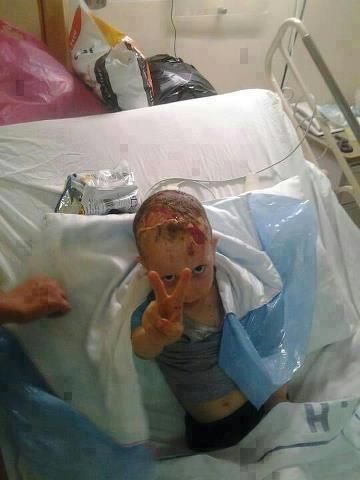 Un petit garçon blessé, à l'hôpital Shifa, Gaza-ville, symbole du courage et de la force des Gazaouis