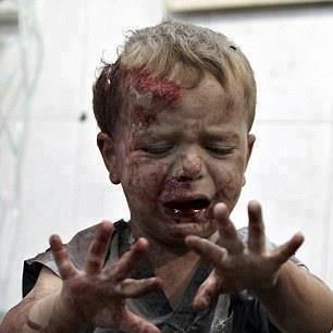 Gaza Kid hurt