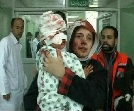 Gaza Child hurt by bombing