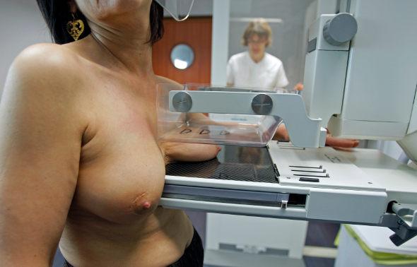 Mammographie, dépistage du cancer dus ein