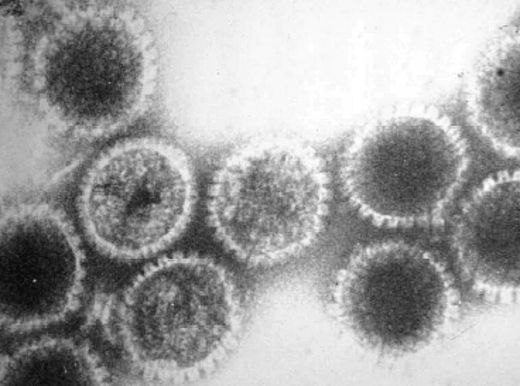 Des virus de l’herpés observés en microscopie électronique. Ce virus appartient à la famille des adénovirus qui contiennent de l'ADN double brin. 