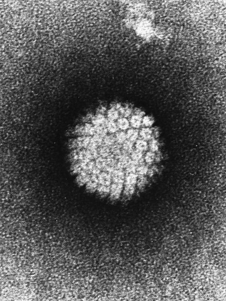 Le papillomavirus humain (ici vu au microscope électronique à transmission) se présente sous plus de 100 voire 200 génotypes différents. Certains sont nocifs quand d'autres, en revanche, pourraient se révéler bénéfiques contre le cancer du col de l'utérus