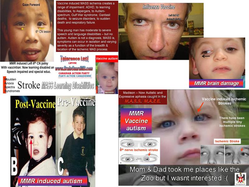 vaccines