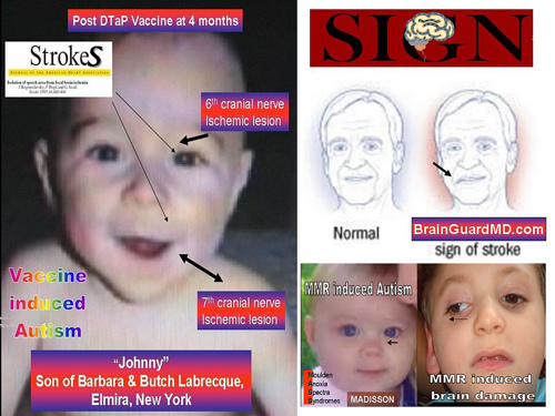 vaccines