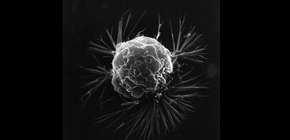 cell cancer