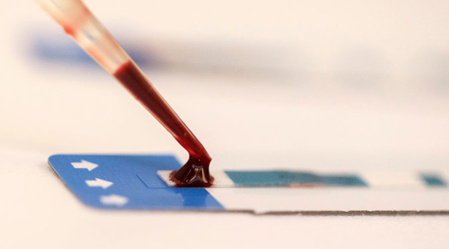 Lab testing blood