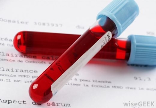 blood vials, blood testing