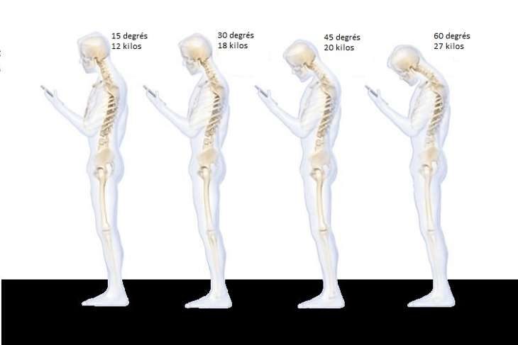 neck, stress, smartphone