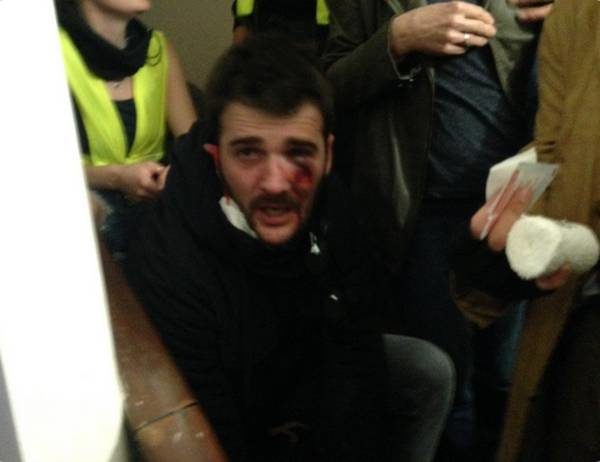 Tir LBD, visage, 1er mai