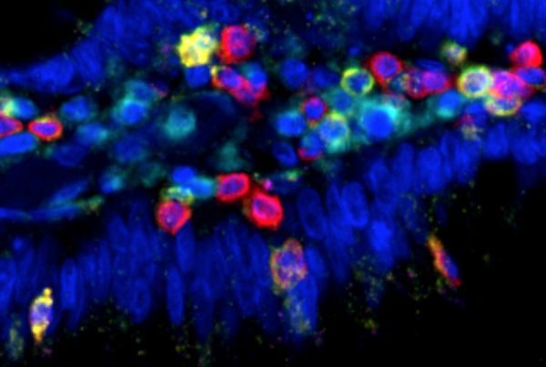cells, cancer