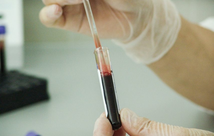 blood, analyse