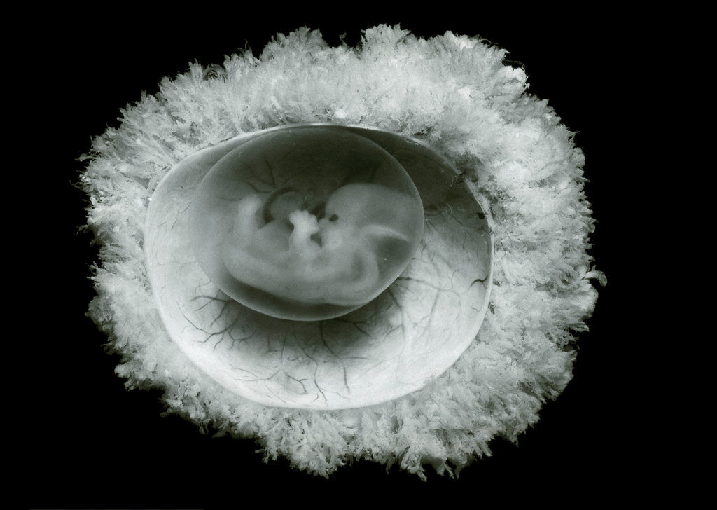 Embryon humain à 45 jours