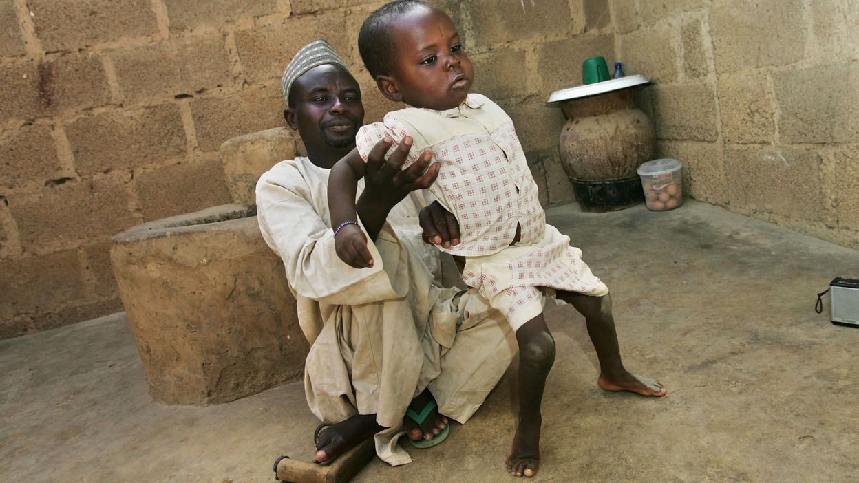 polio