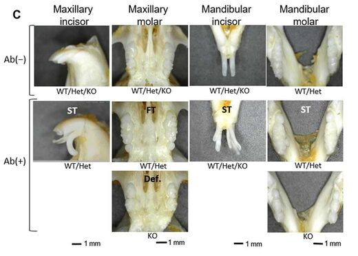 Des chercheurs ont découvert un anticorps qui régénère les dents Julie Kern Futura Sciences mar., 30 mar. 2021 18:55 UTC 71066b1f5c_50174781_croissance