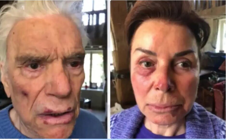 tapie