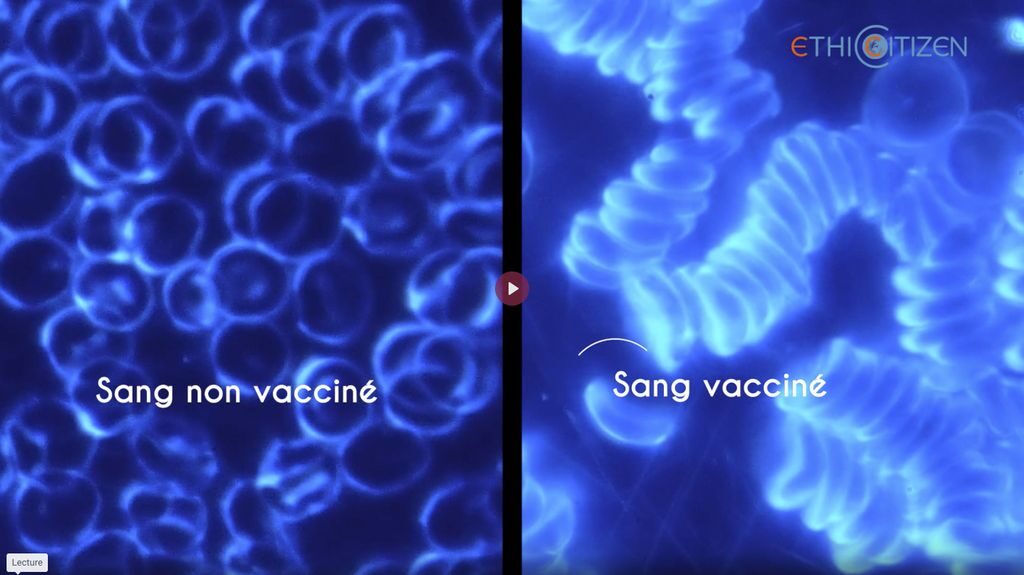 Sang vacciné Covid versus sang non vacciné Covid