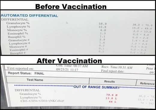 Un médecin effectue un test sanguin et immunitaire avant et après une vaccination contre le COVID, les résultats alarmants le motivent à partager cette vidéo Vaccine_Immunity_Impact_3_Befo