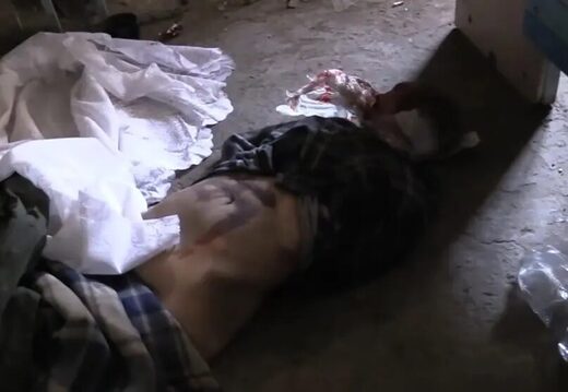 Une femme victime de tortures de la part des combattants de l’unité nationaliste ukrainienne “Azov “*