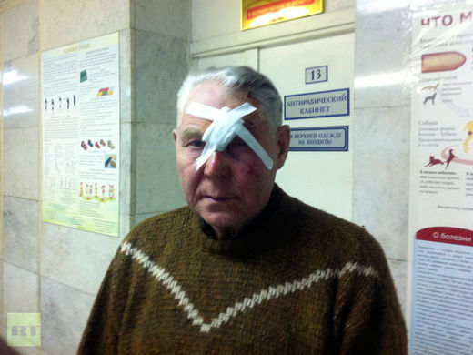 Un homme s'étant présenté sous le nom de Viktor pose pour une photo après avoir été soigné pour des blessures dans un hôpital de Tcheliabinsk.