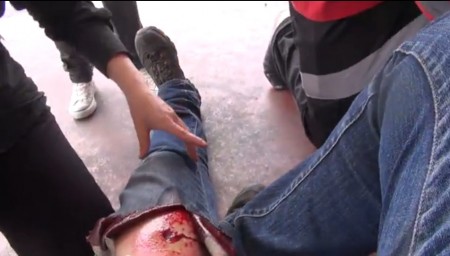 Militante israélienne blessée par la police israélienne