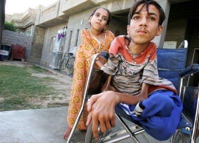 Anas Hamed et sa sœur Ines, qui souffrent de malformations à la naissance, photographiés le 12 novembre 2009 à Falloujah